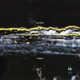 Gilla Band: <br>Pugnello [CD]